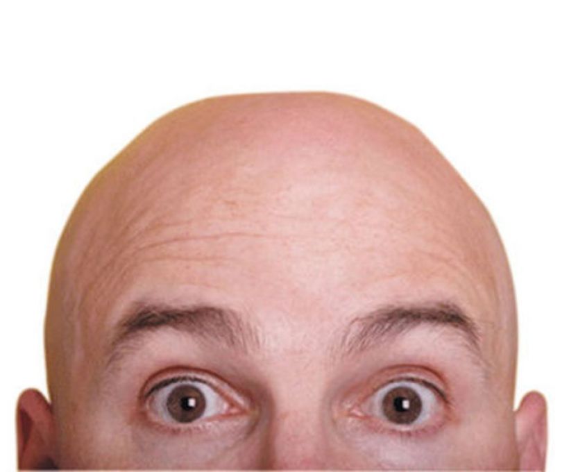 Careca